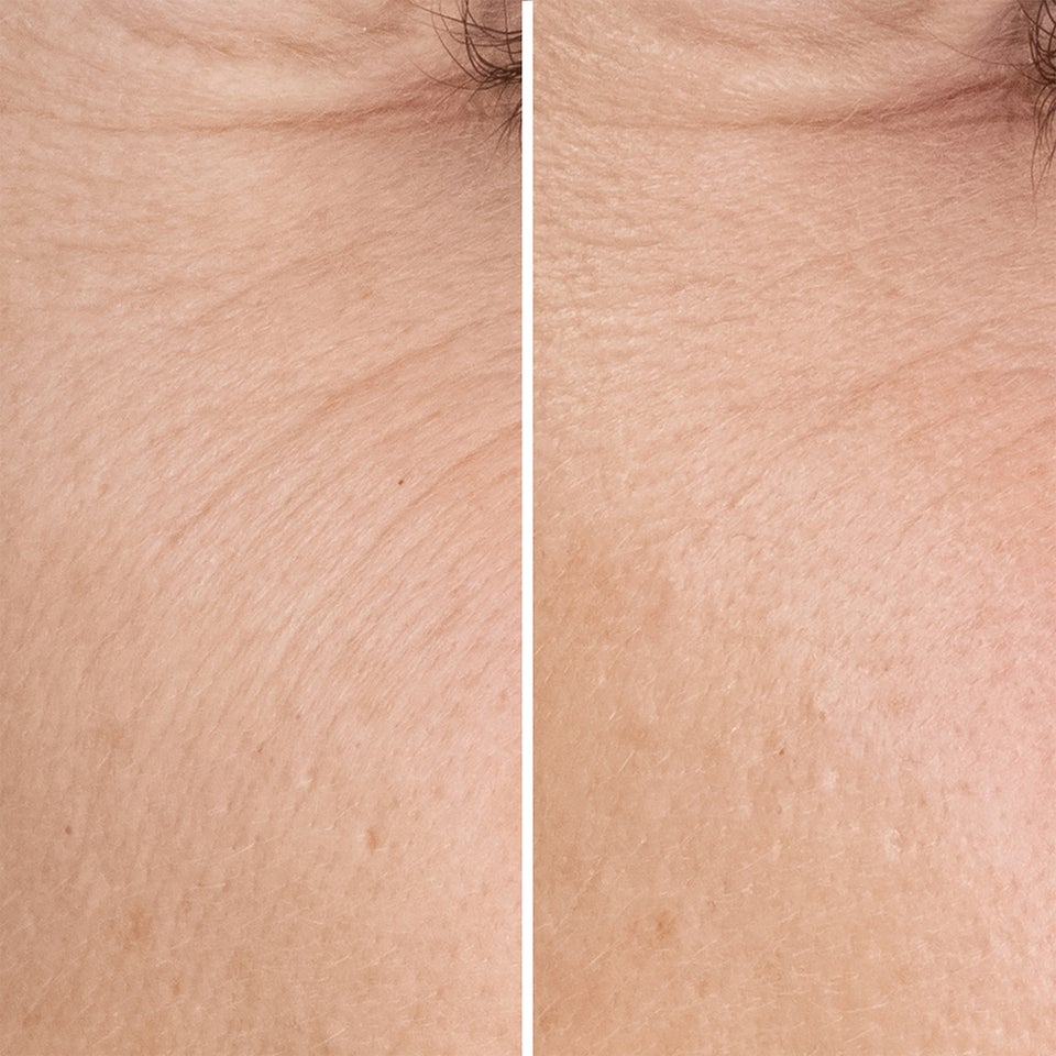 Blue Therapy Accelerated Anti-Aging Serum